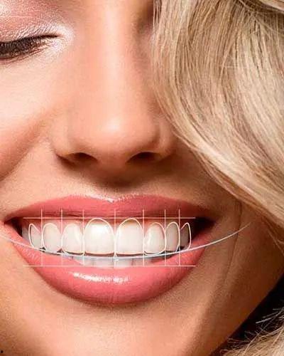 明星的牙齿怎么做到的,揭秘明星完美笑容的打造之道